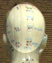 back of head pain location