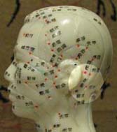 Right occipital pain location