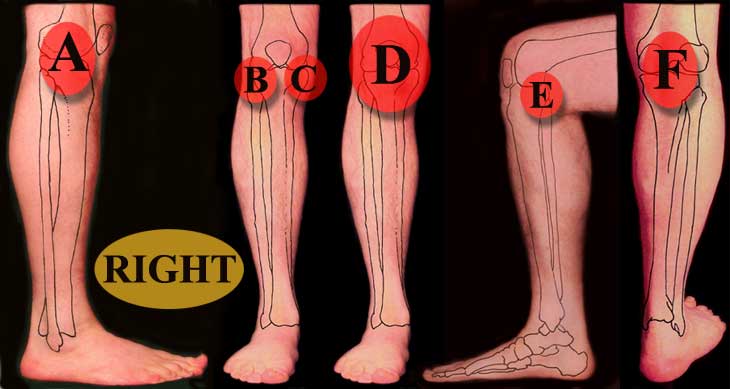 Knee Pain Locations